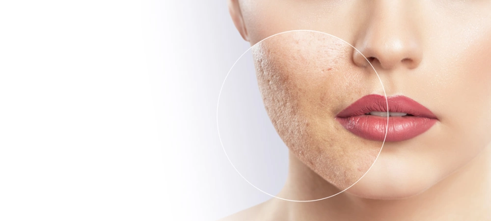 Дерматология