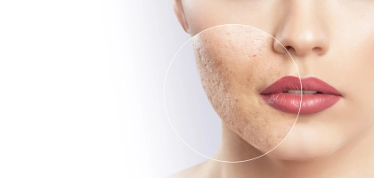 Дерматология