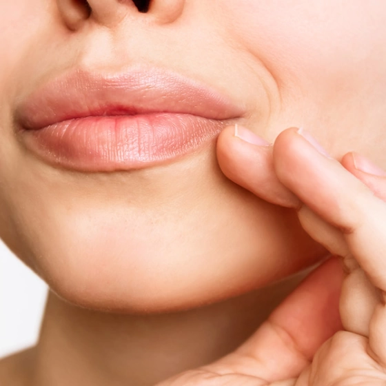 Хирургическая пластика губ по методу «Булхорн»