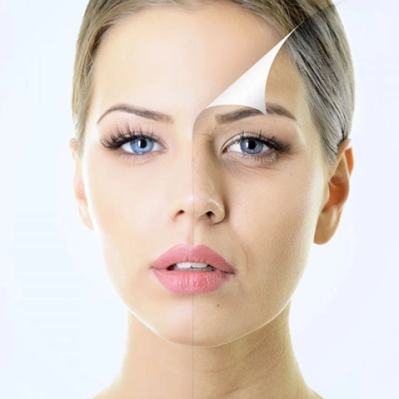 Всё что вам нужно знать о липофилинге