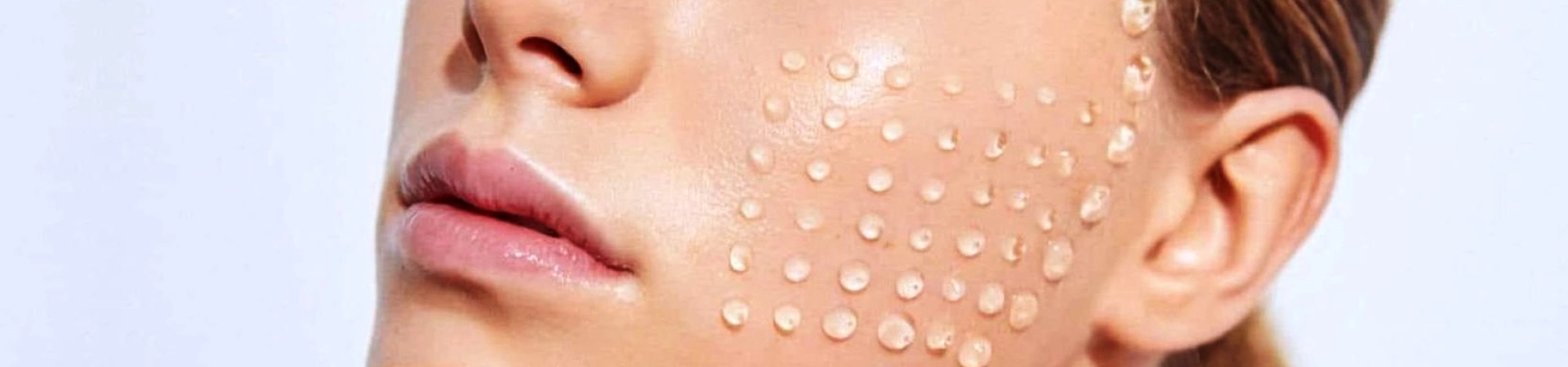 Биоревитализации – как выбрать препарат?