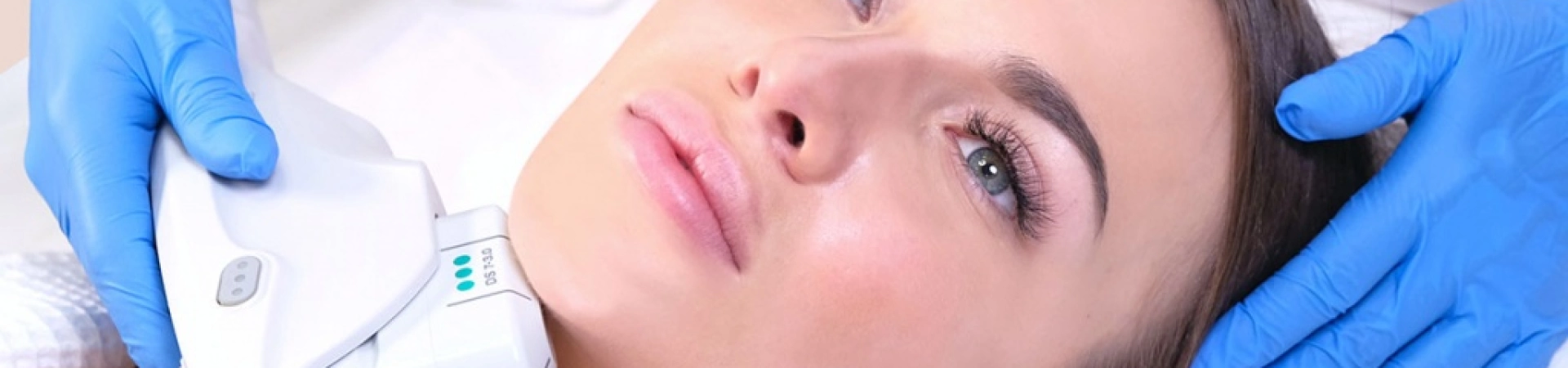 SMAS-лифтинг против RF: полный гид по современным методам подтяжки