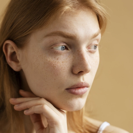 Лечение пигментации