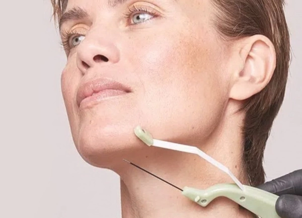 Радиочастотная подтяжка FaceTite