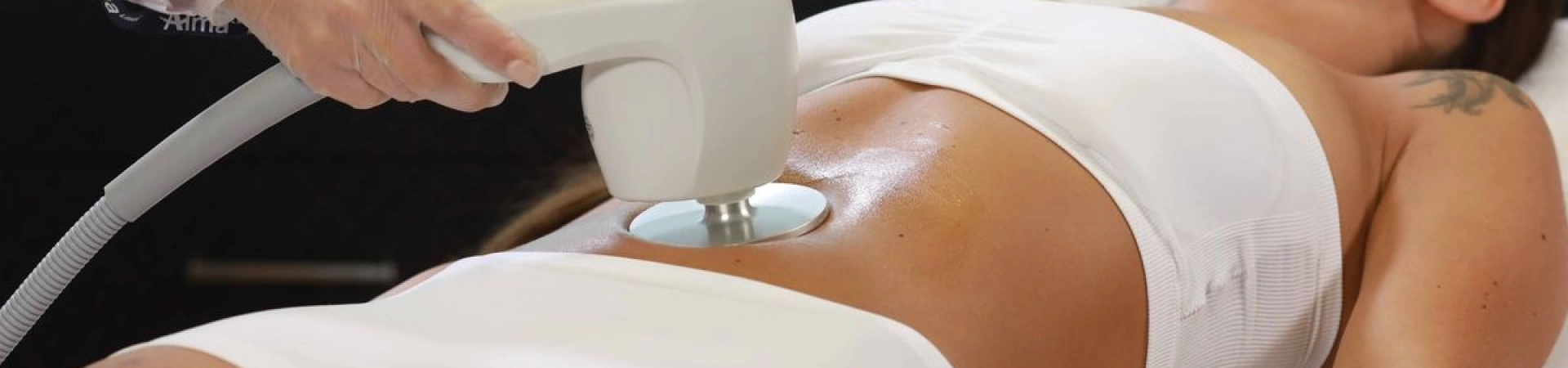 Радиоволновой RF-Лифтинг