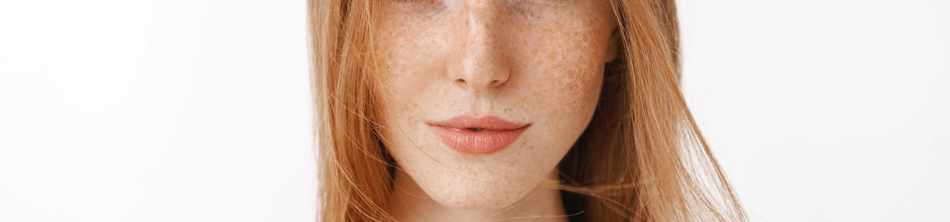 Лечение глубокой пигментации лазером (мелазмы)