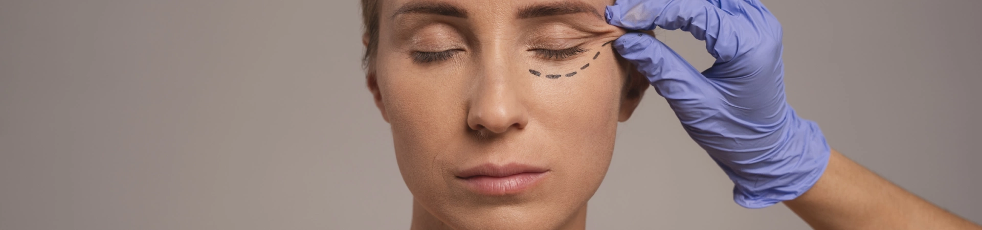 Блефаропластика