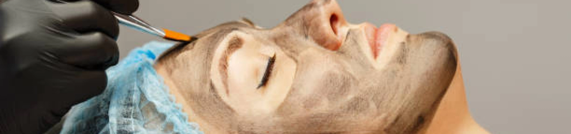 Лазерный карбоновый пилинг