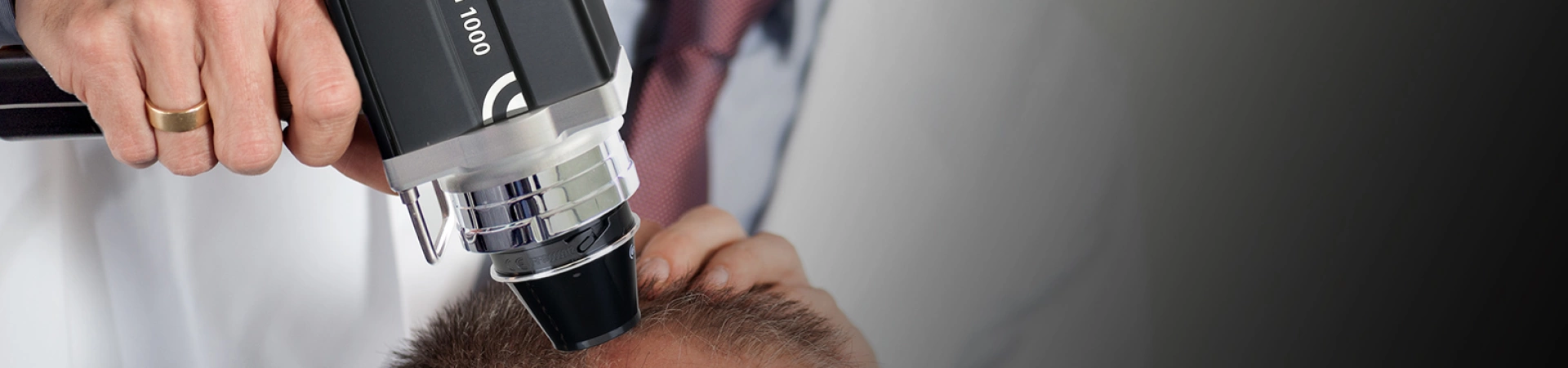 Диагностика волос и кожи головы