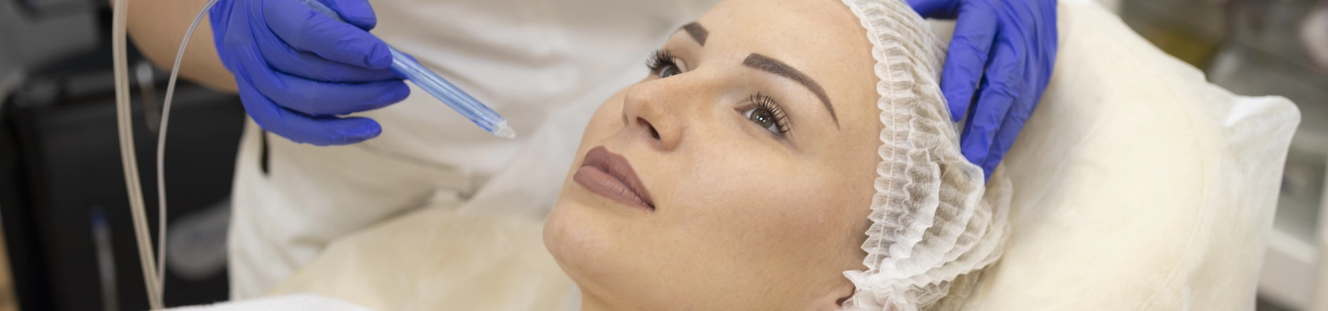 Газожидкостный пилинг