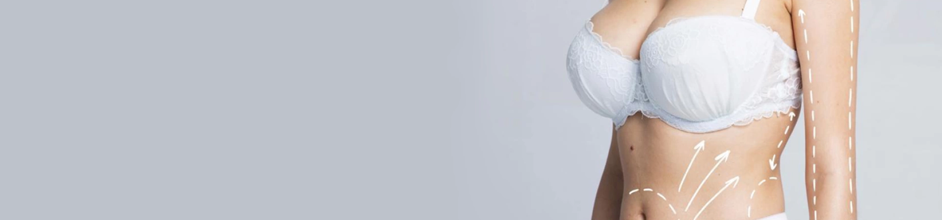 Липофилинг