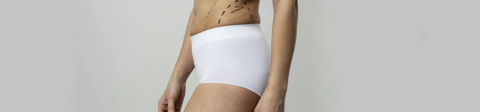 Бодилифтинг (подтяжка тела)