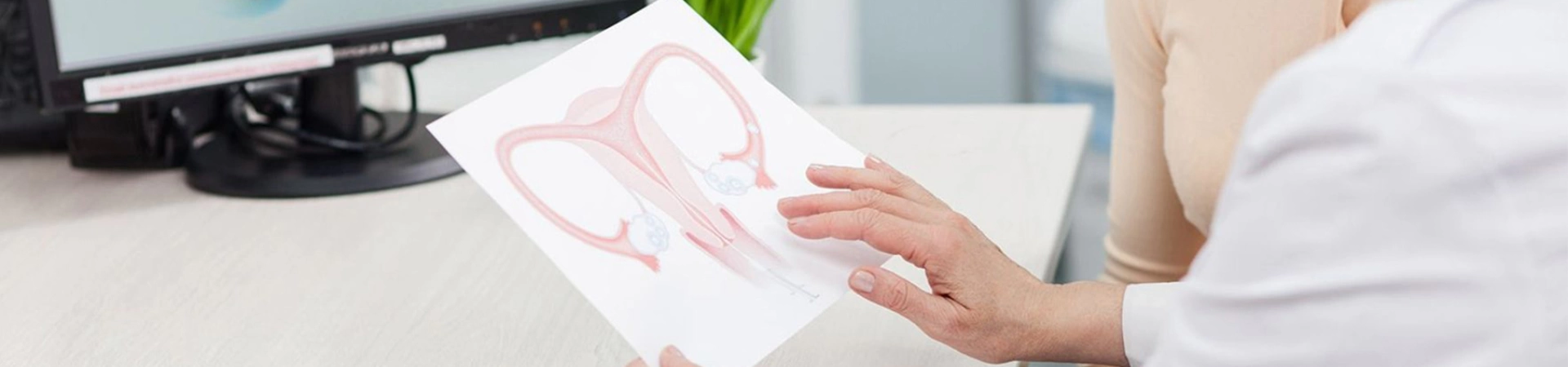 Прием гинеколога