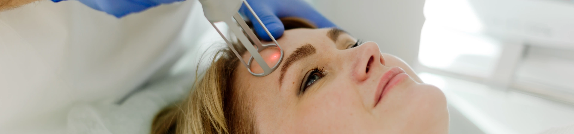 Фракционное аблятивное омоложение (шлифовка)