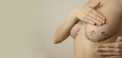 Коррекция груди (деформация, асимметрия)