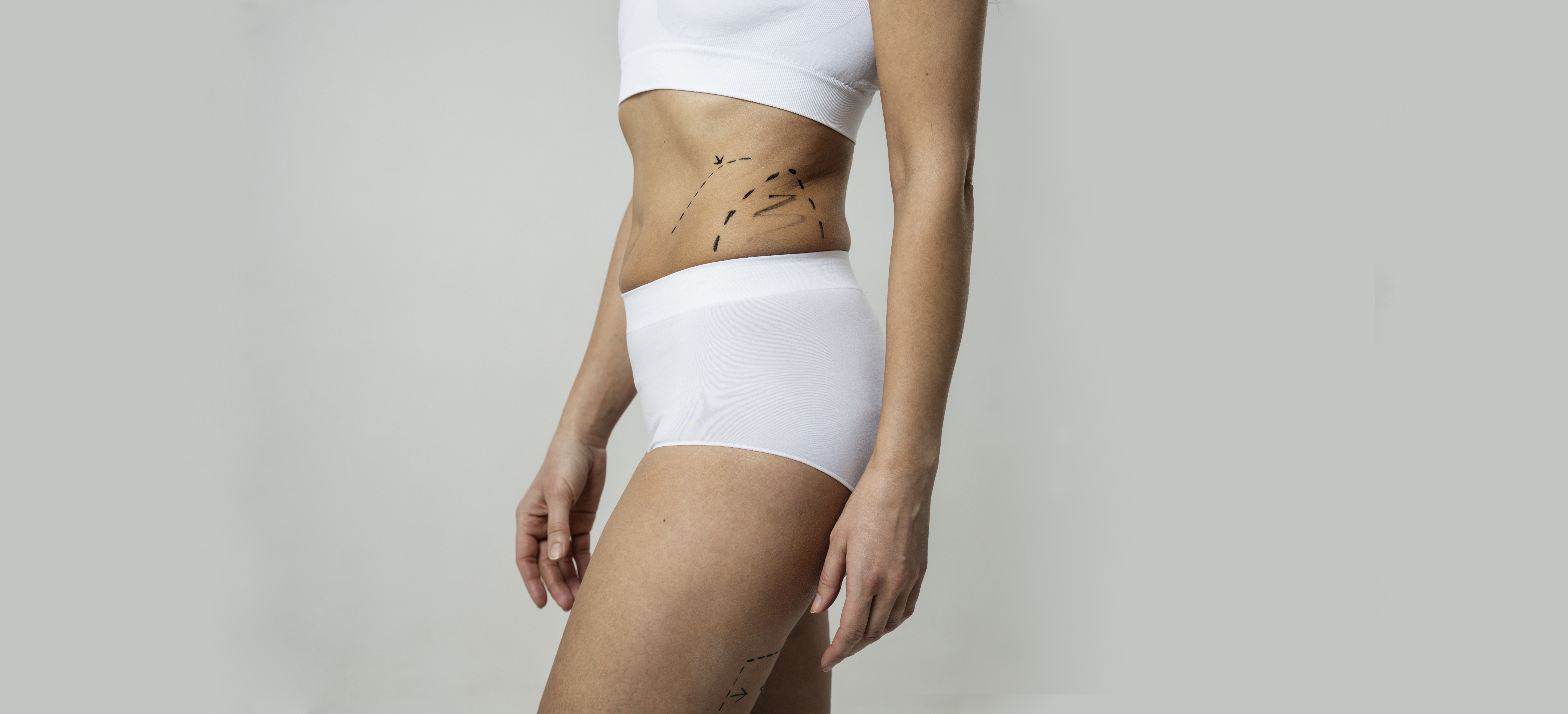 Бодилифтинг (подтяжка тела)